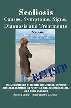Scoliosis: Revised Edition: Causes, Symptoms, Signs, Diagnosis and Treatments